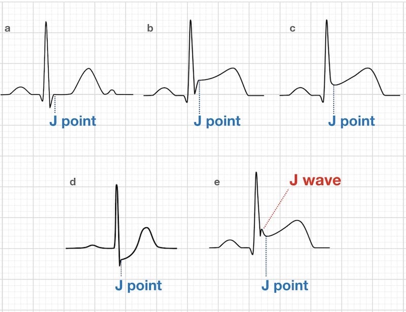 j point diagram